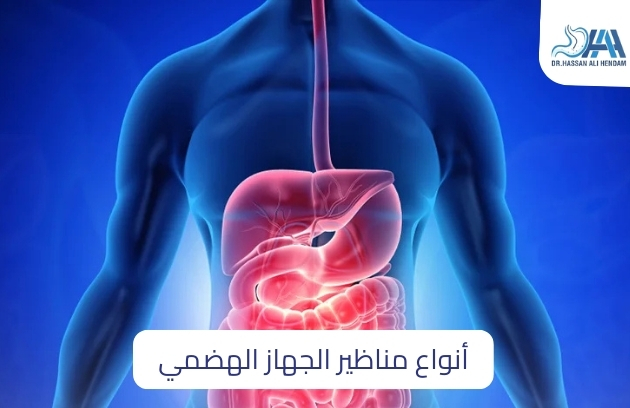 أنواع مناظير الجهاز الهضمي