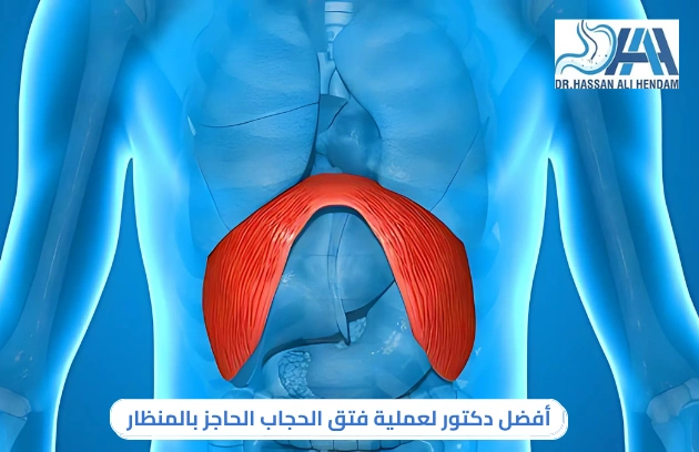 سعر عملية فتق الحجاب الحاجز بالمنظار