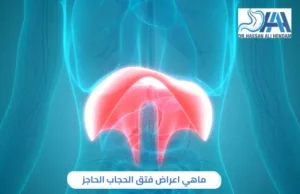 ماهي اعراض فتق الحجاب الحاجز