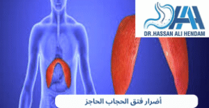 أضرار فتق الحجاب الحاجز