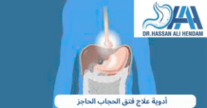 أدوية علاج فتق الحجاب الحاجز