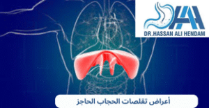 أعراض تقلصات الحجاب الحاجز