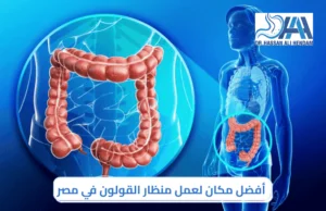 أفضل مكان لعمل منظار القولون في مصر