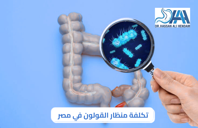 تكلفة منظار القولون في مصر