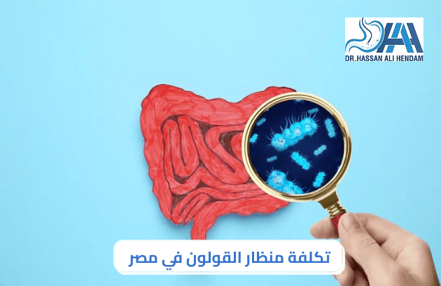تكلفة منظار القولون في مصر