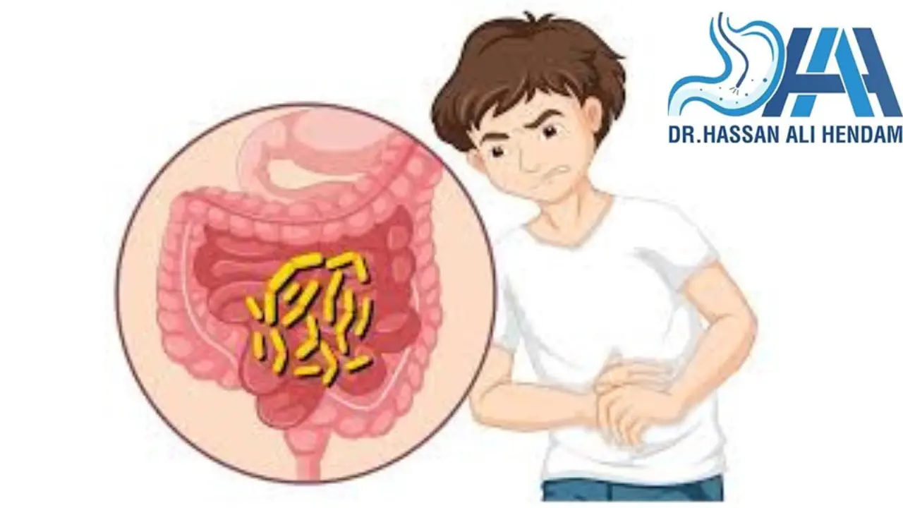 اعراض جرثومة المعدة النفسية