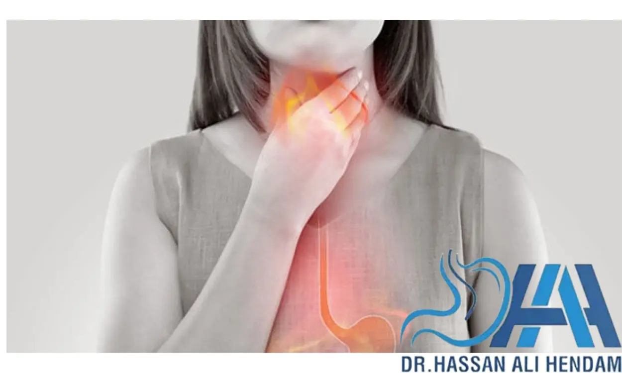 اعراض ارتجاع المرئ الصامت