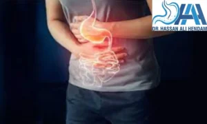 اعراض ما بعد علاج جرثومة المعدة