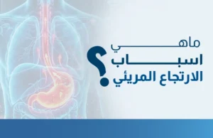 ماهي اسباب الارتجاع المريئي