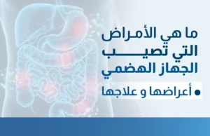 ما هي الامراض التي تصيب الجهاز الهضمي