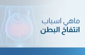 ماهي اسباب انتفاخ البطن
