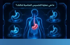 افضل انواع عمليات التخسيس