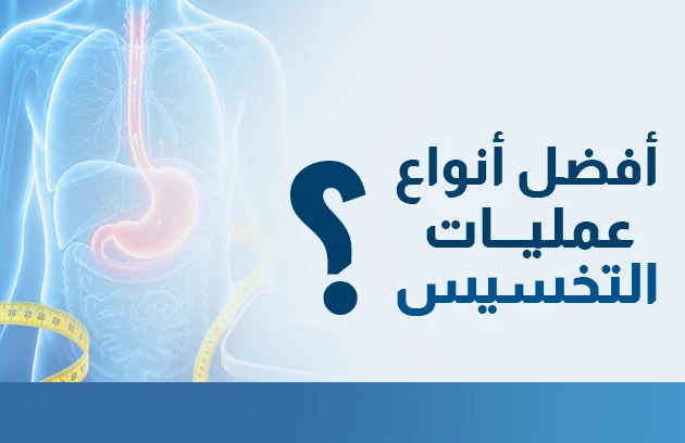 افضل انواع عمليات التخسيس