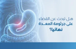 القضاء على جرثومة المعدة نهائيا