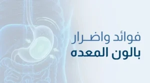 بالون المعده