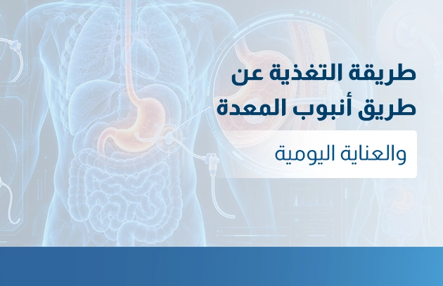 طريقة التغذية عن طريق أنبوب المعدة